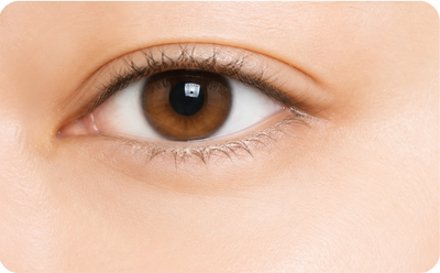 After Fine Lines