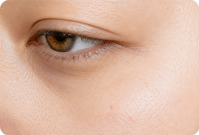 Before Dull Skin